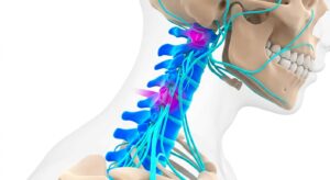 교통사고 시 인체에 가해지는 물리적 충격과 편타성 손상 기전을 보여주는 3D 의학 일러스트